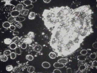 dunkelfeldmikroskopie